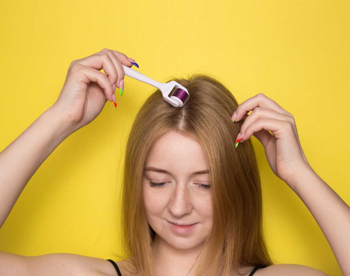 Scalp microneedling therapy