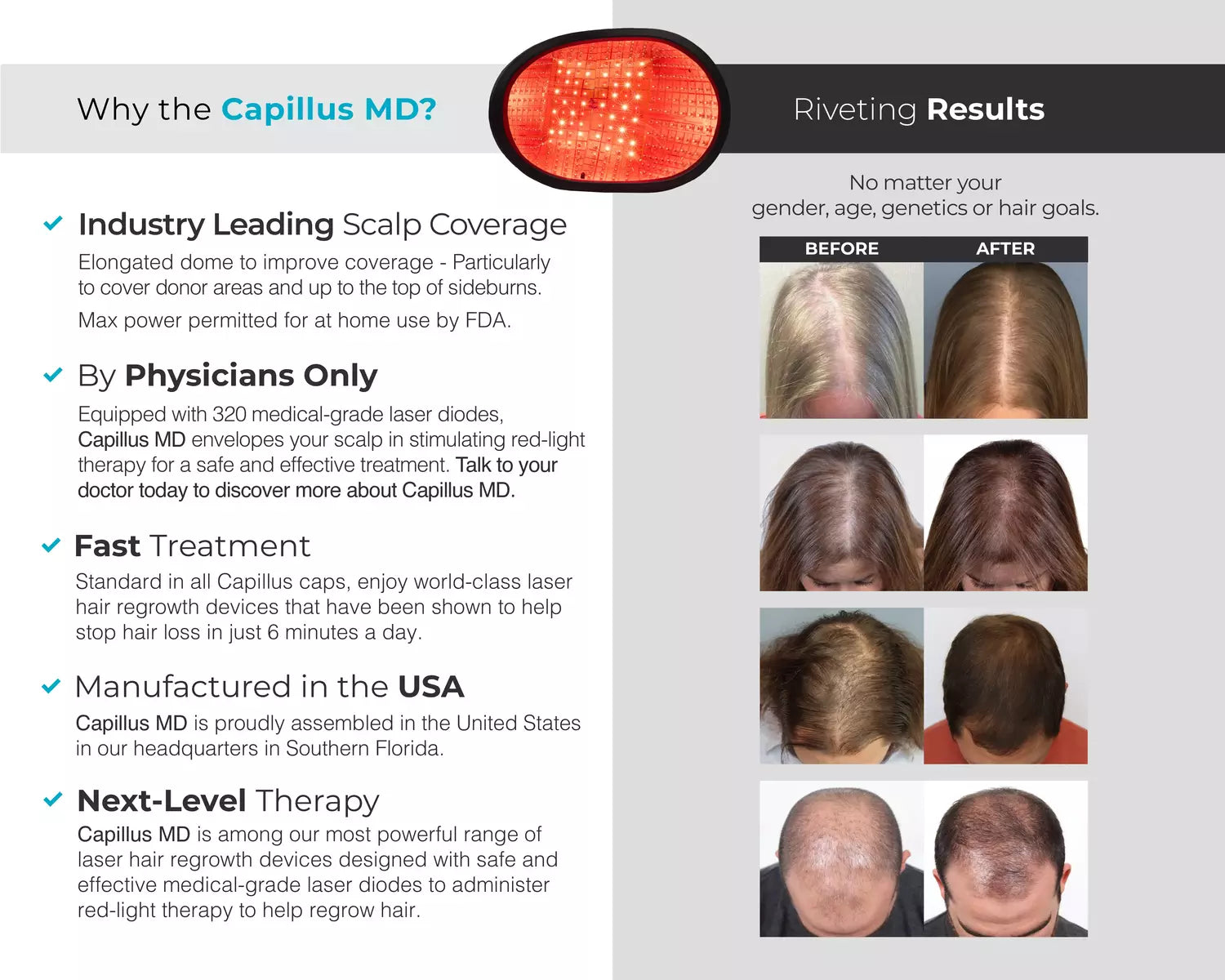 Capillus MD Results