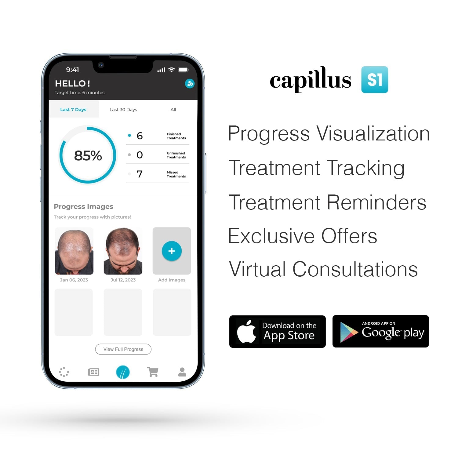 Capillus PRO S2